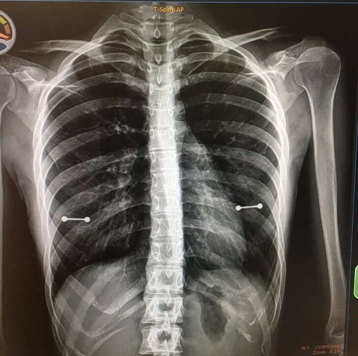 20 человек, которых настиг худший день в их жизни (21 фото)