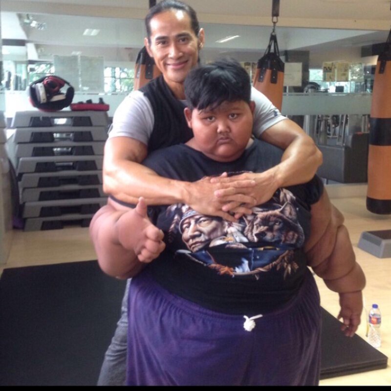 Самый толстый ребенок в мире похудел более чем на 100 килограмм (11 фото)