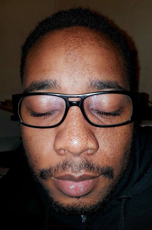 Не мутанты, а люди с редкими генетическими аномалиями (12 фото)