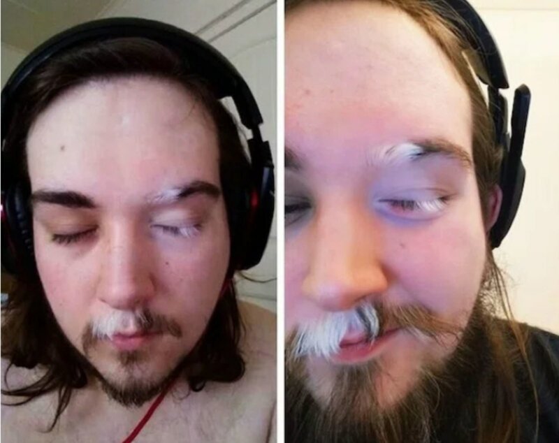 20 прекрасных генетических мутаций у людей (21 фото)