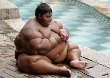 Самый толстый ребенок в мире похудел более чем на 100 килограмм (11 фото)
