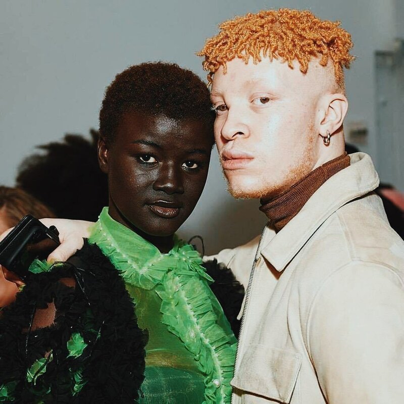 20 прекрасных генетических мутаций у людей (21 фото)