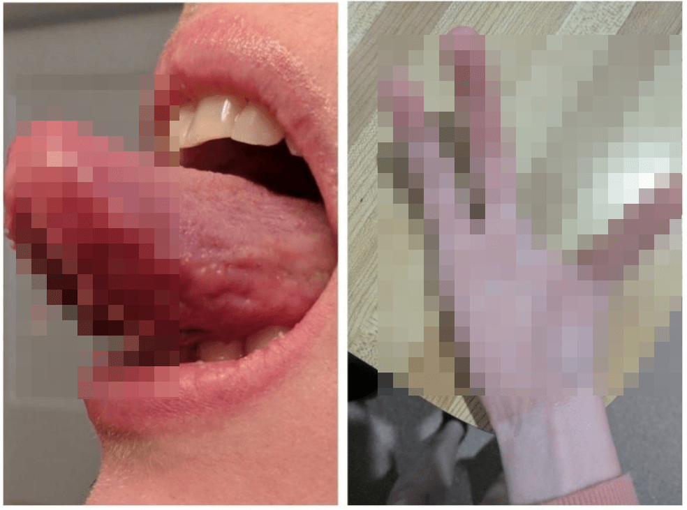 Не мутанты, а люди с редкими генетическими аномалиями (12 фото)