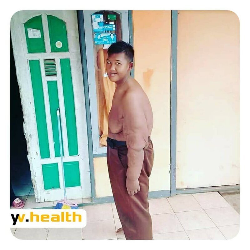 Самый толстый ребенок в мире похудел более чем на 100 килограмм (11 фото)