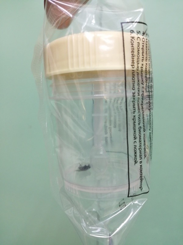 Контейнер для биоматериала с "бонусом" (4 фото)