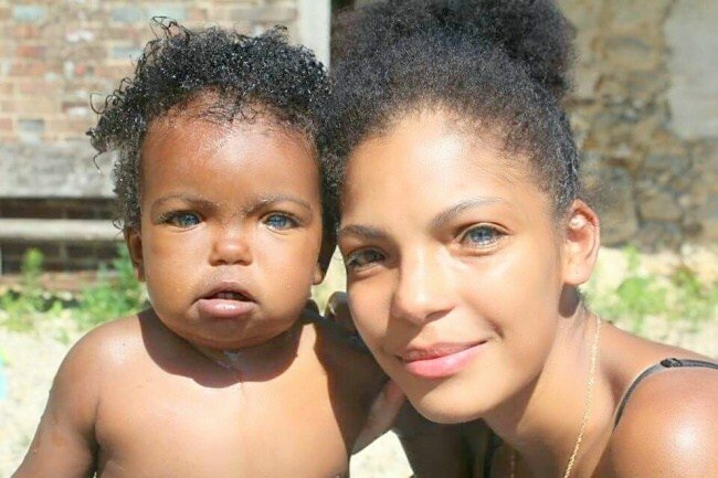 20 прекрасных генетических мутаций у людей (21 фото)