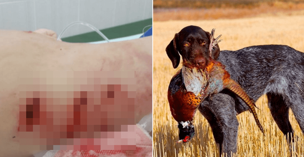 Грызла 20 минут: охотничья собака напала на трехлетнего ребенка прямо на детской площадке (7 фото) Грызла 20 минут: охотничья собака напала на трехлетнего ребенка прямо на детской площадке (7 фото)