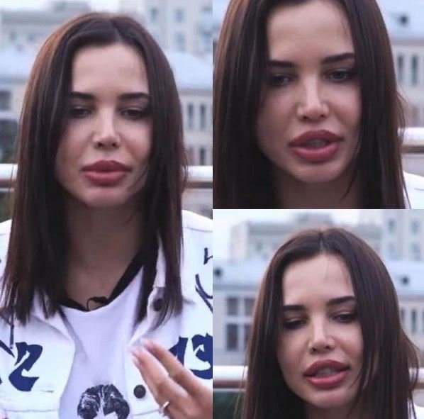 Щетину скрывает? Решетова опозорилась перед фанатами «отфотошопленной» подмышкой
