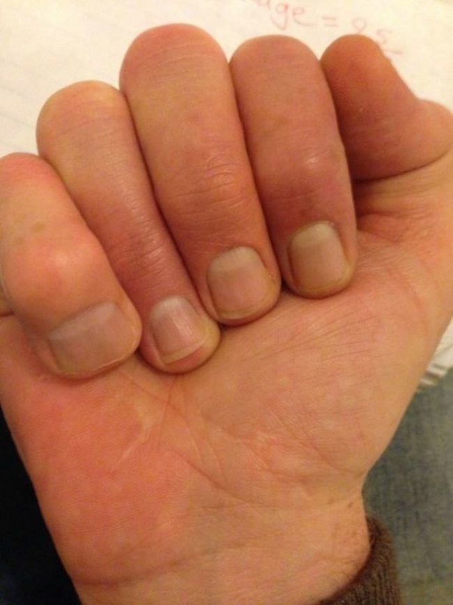 Не мутанты, а люди с редкими генетическими аномалиями (12 фото)