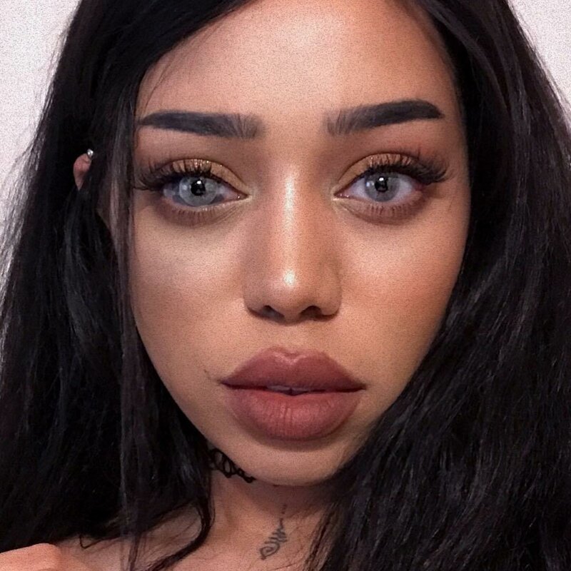 20 прекрасных генетических мутаций у людей (21 фото)