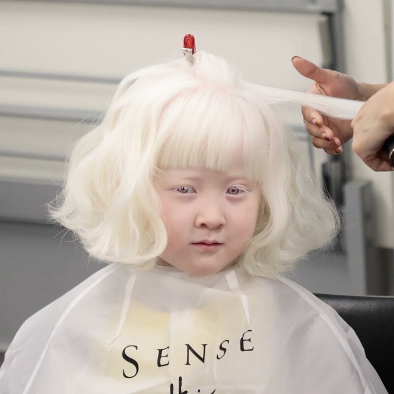 20 прекрасных генетических мутаций у людей (21 фото)