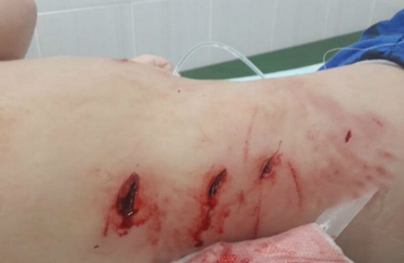 Грызла 20 минут: охотничья собака напала на трехлетнего ребенка прямо на детской площадке (7 фото) Грызла 20 минут: охотничья собака напала на трехлетнего ребенка прямо на детской площадке (7 фото)