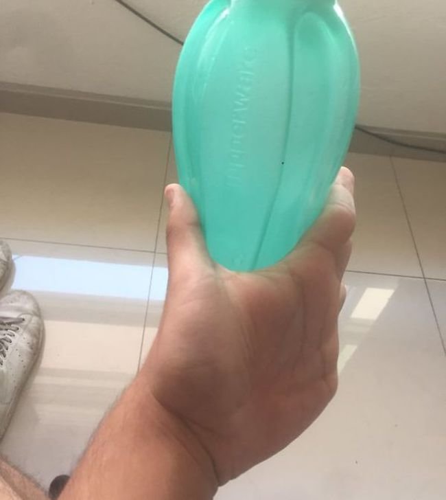 Не мутанты, а люди с редкими генетическими аномалиями (12 фото)