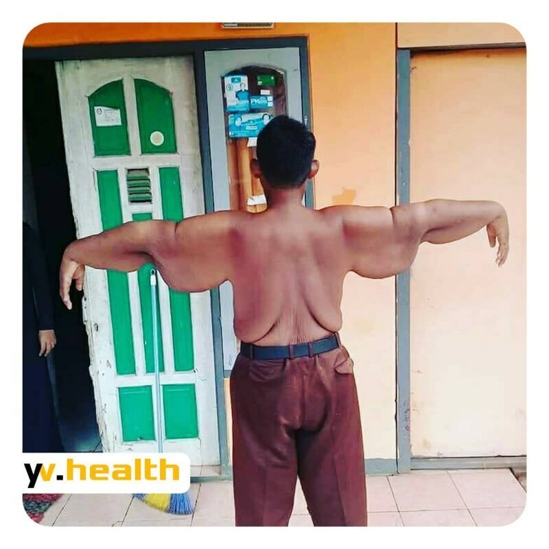 Самый толстый ребенок в мире похудел более чем на 100 килограмм (11 фото)