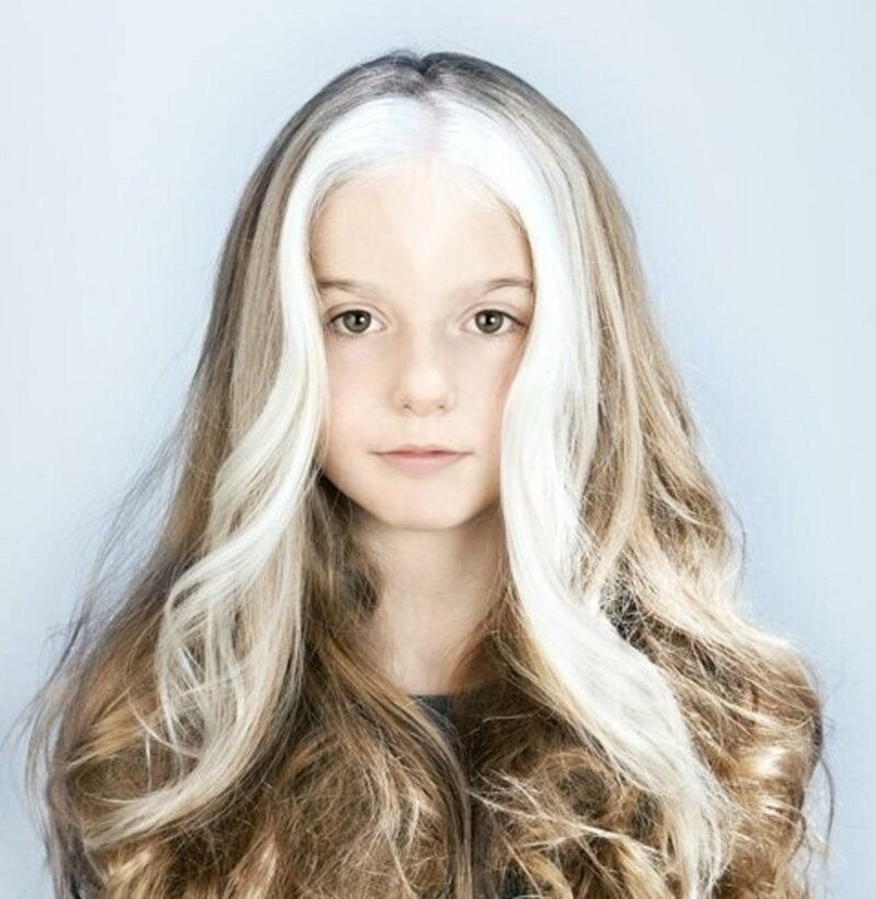 20 прекрасных генетических мутаций у людей (21 фото)