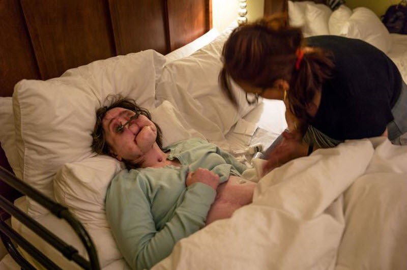 Шокирующая история надежды: после неудачной попытки самоубийства девушка получила новое лицо (15 фото) Шокирующая история надежды: после неудачной попытки самоубийства девушка получила новое лицо (15 фото)