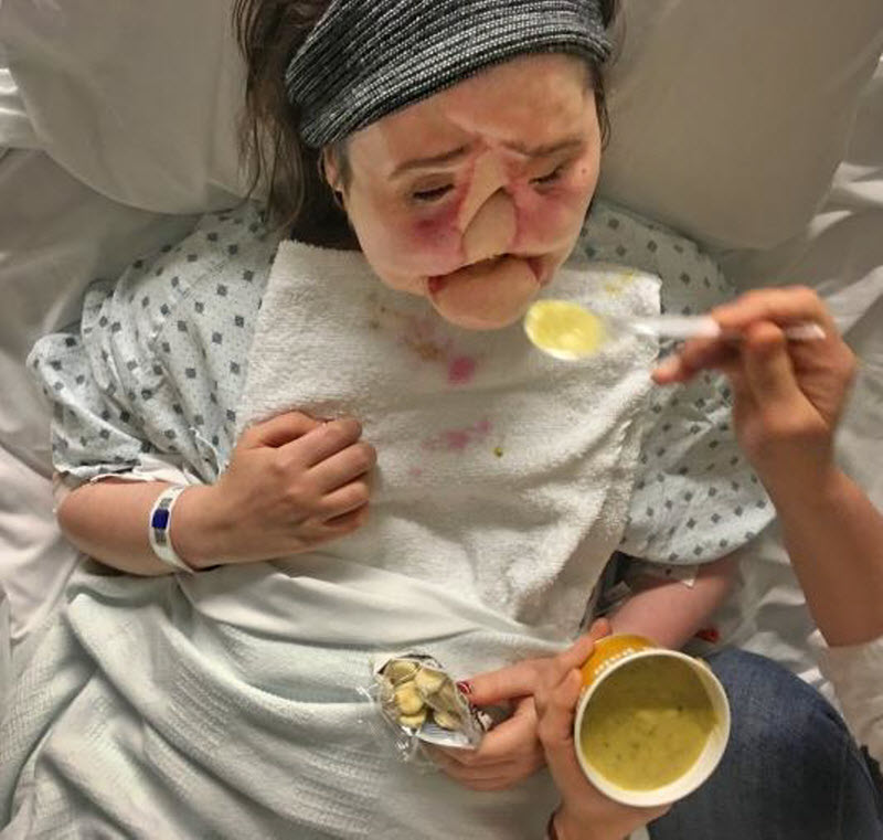 Шокирующая история надежды: после неудачной попытки самоубийства девушка получила новое лицо (15 фото) Шокирующая история надежды: после неудачной попытки самоубийства девушка получила новое лицо (15 фото)