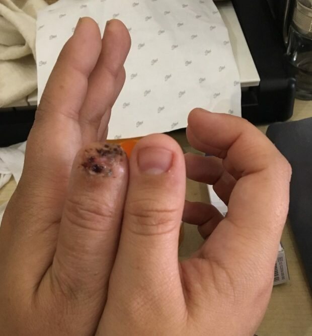 Парень откусил подруге палец из-за ночного кошмара (8 фото)