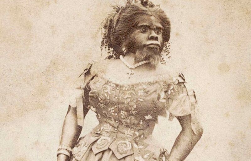 Хулия Пастрана — чудовище, которое все любили (2 фото)