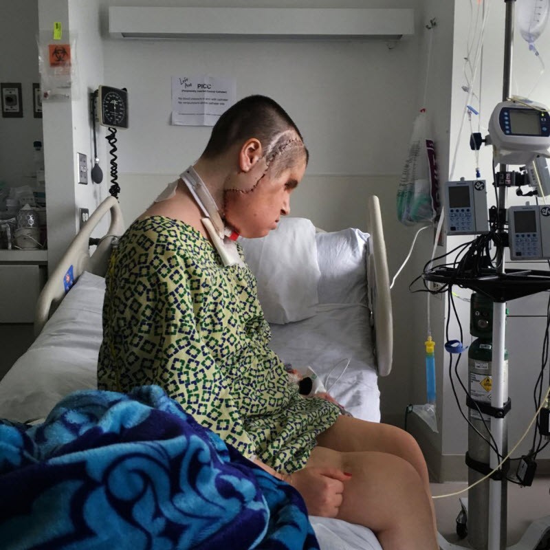 Шокирующая история надежды: после неудачной попытки самоубийства девушка получила новое лицо (15 фото) Шокирующая история надежды: после неудачной попытки самоубийства девушка получила новое лицо (15 фото)