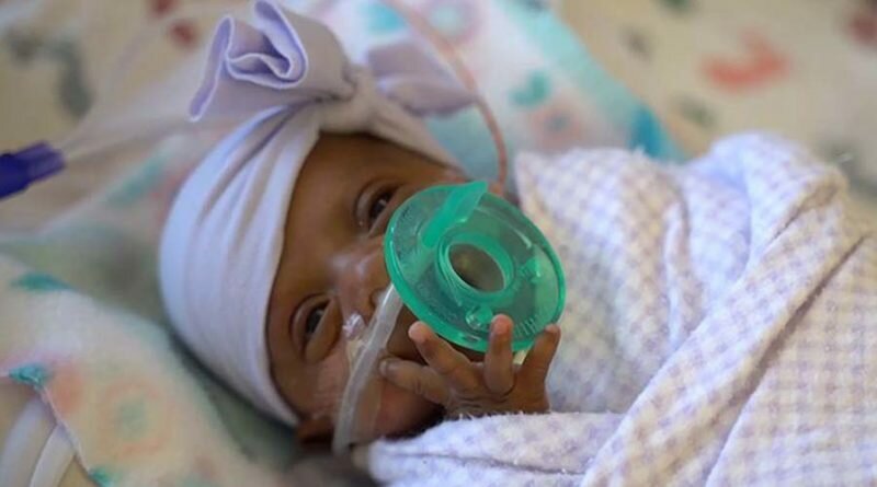 Самая маленькая новорожденная в мире была размером с яблоко (7 фото) Самая маленькая новорожденная в мире была размером с яблоко (7 фото)