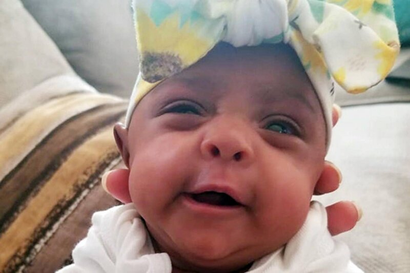 Самая маленькая новорожденная в мире была размером с яблоко (7 фото) Самая маленькая новорожденная в мире была размером с яблоко (7 фото)