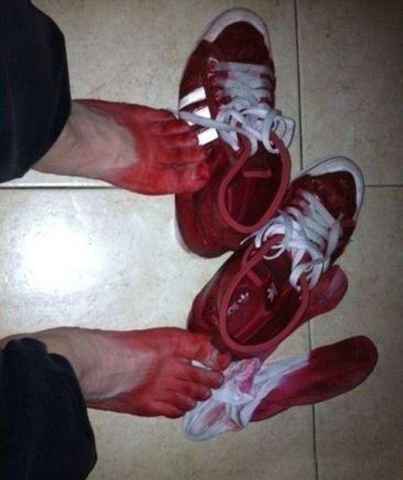 Угодил под дождь в китайских Adidas (2 фото)