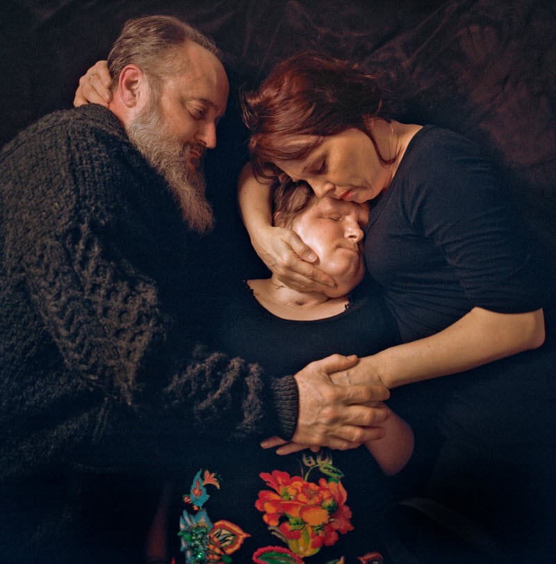 Шокирующая история надежды: после неудачной попытки самоубийства девушка получила новое лицо (15 фото) Шокирующая история надежды: после неудачной попытки самоубийства девушка получила новое лицо (15 фото)