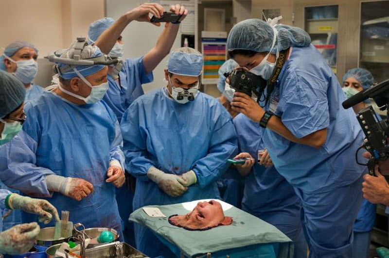 Шокирующая история надежды: после неудачной попытки самоубийства девушка получила новое лицо (15 фото) Шокирующая история надежды: после неудачной попытки самоубийства девушка получила новое лицо (15 фото)