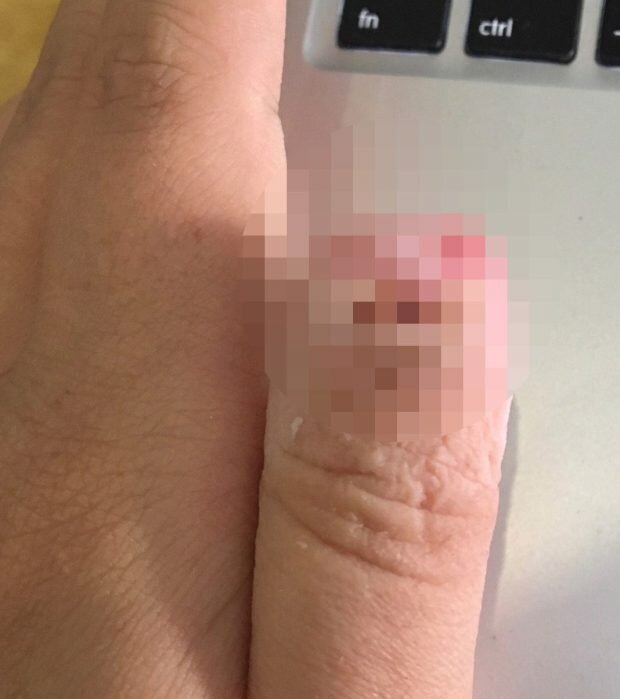 Парень откусил подруге палец из-за ночного кошмара (8 фото)