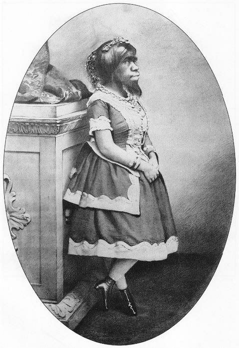 Хулия Пастрана — чудовище, которое все любили (2 фото)