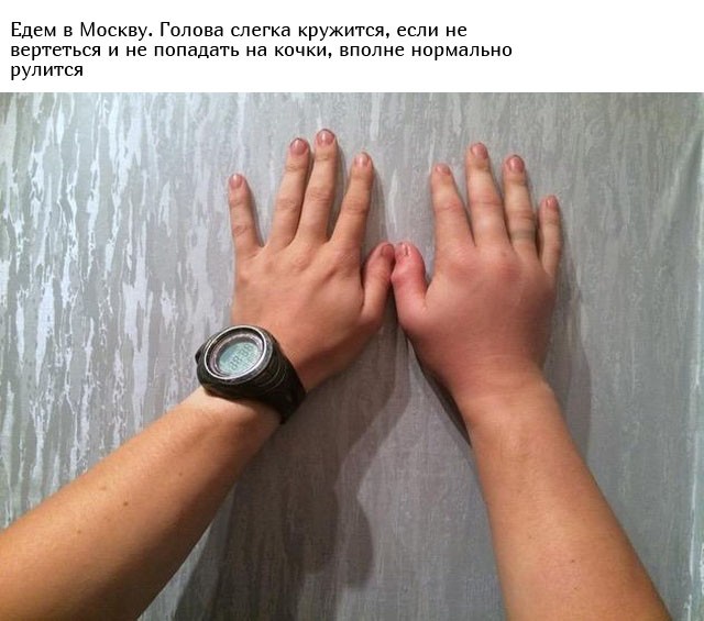 Укус гадюки из первых уст (12 фото)