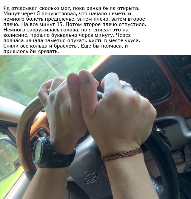 Укус гадюки из первых уст (12 фото)