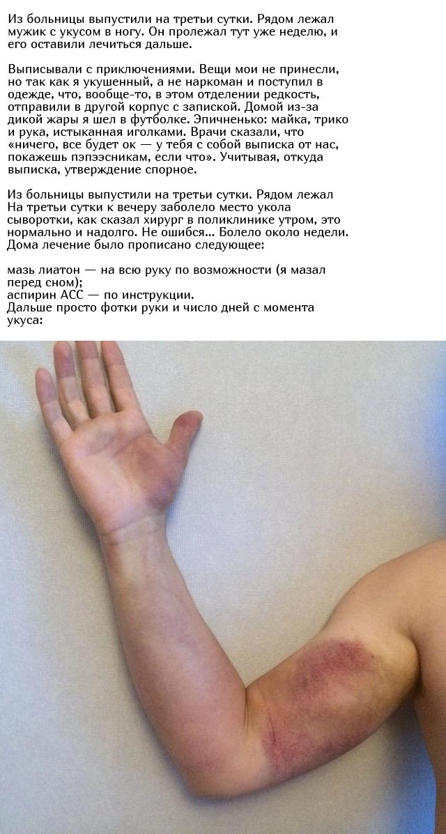 Укус гадюки из первых уст (12 фото)