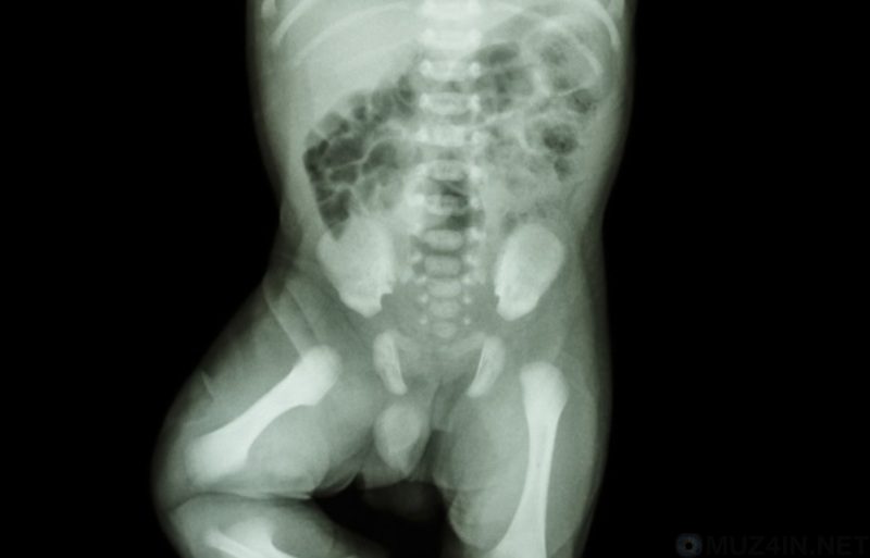 Удивительные научные факты о новорожденных (9 фото)