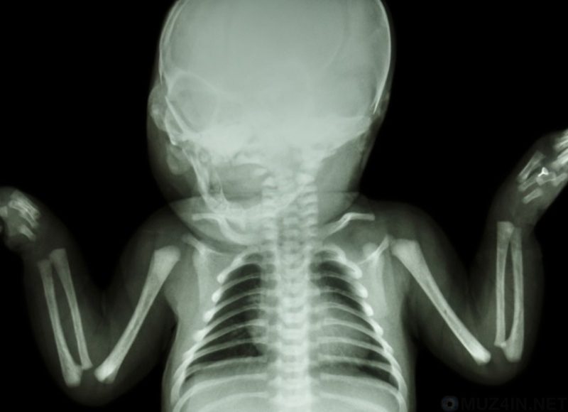 Удивительные научные факты о новорожденных (9 фото)