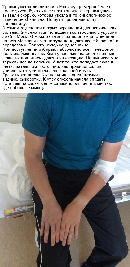 Укус гадюки из первых уст (12 фото)