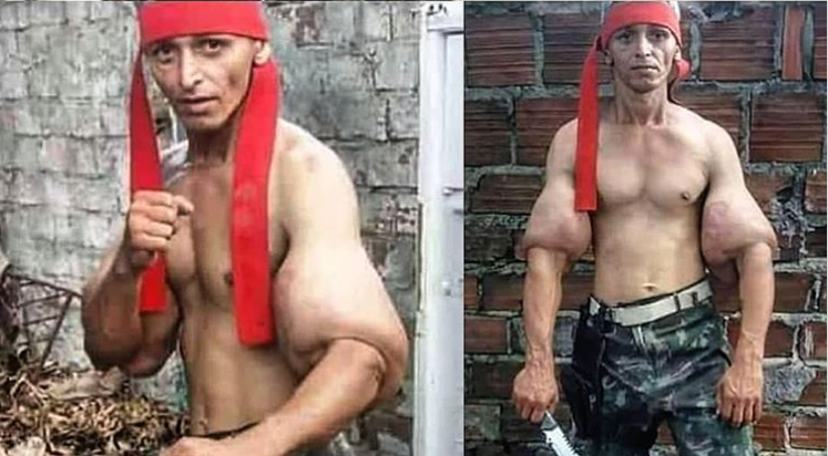 Фанат Сталлоне закачал в руки синтол, чтобы быть как Рэмбо (3 фото) Фанат Сталлоне закачал в руки синтол, чтобы быть как Рэмбо (3 фото)