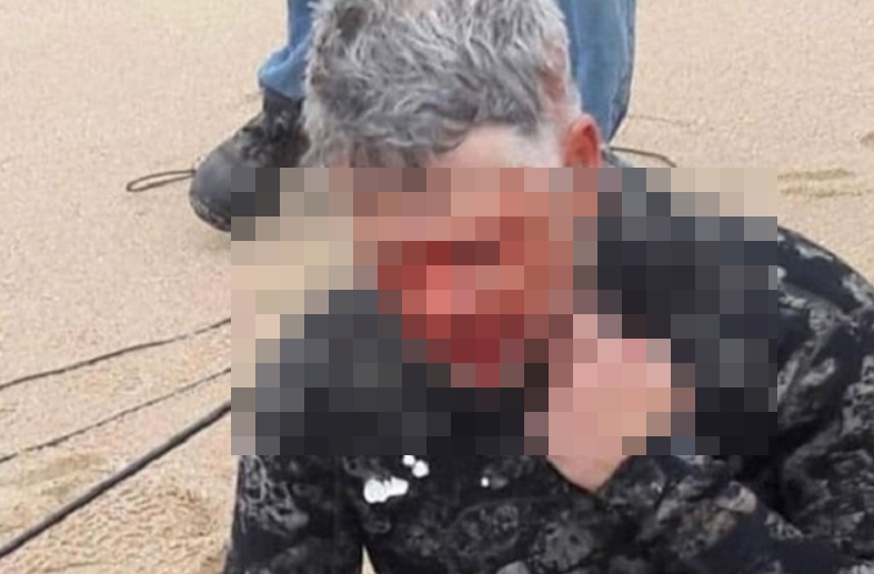 Аквалангист из ЮАР нечаянно выстрелил себе в голову гарпуном (3 фото)