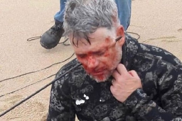 Аквалангист из ЮАР нечаянно выстрелил себе в голову гарпуном (3 фото)