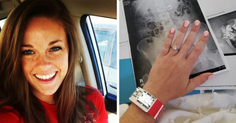 Девушке приснилось, будто она проглотила свое кольцо. Наутро сон оказался реальностью (11 фото)