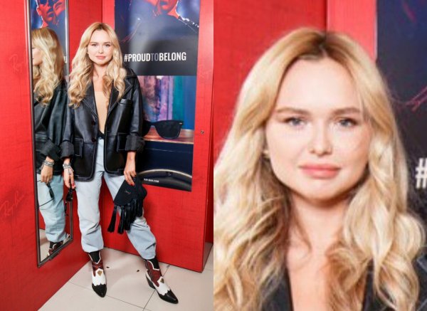 Лицо шире плеч! Дочь Маликова снова переборщила с «уколами красоты» 