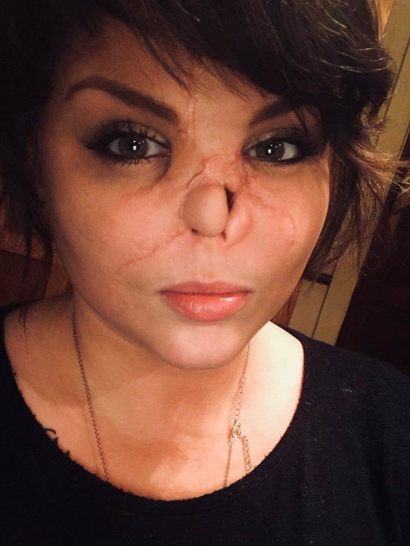 Изуродованная любовь (10 фото) Изуродованная любовь (10 фото)