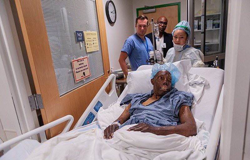 Первый чернокожий человек с донорским лицом (9 фото)