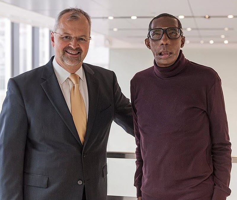 Первый чернокожий человек с донорским лицом (9 фото)