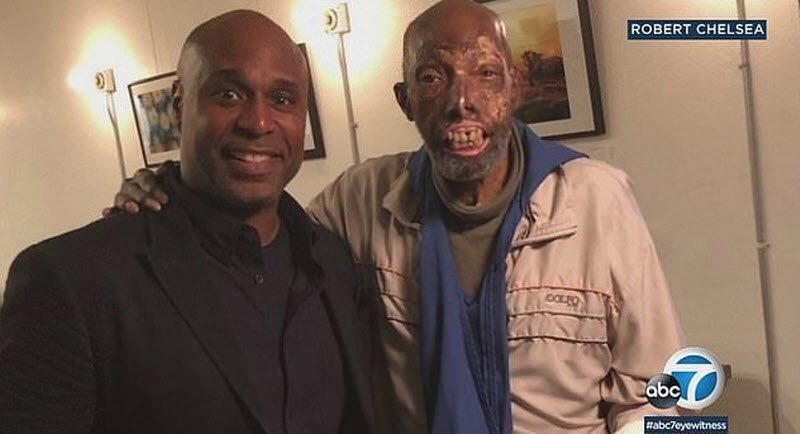 Первый чернокожий человек с донорским лицом (9 фото)