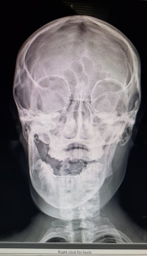 Подборка "нежданчиков" и неудач (15 фото)