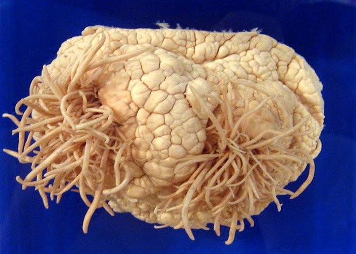 Не для слабонервных: топ-5 самых отвратительных и жутких музеев мира (30 фото)