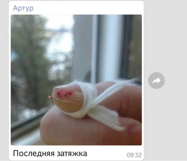 Порезанный палец стал героем мемов (7 фото)