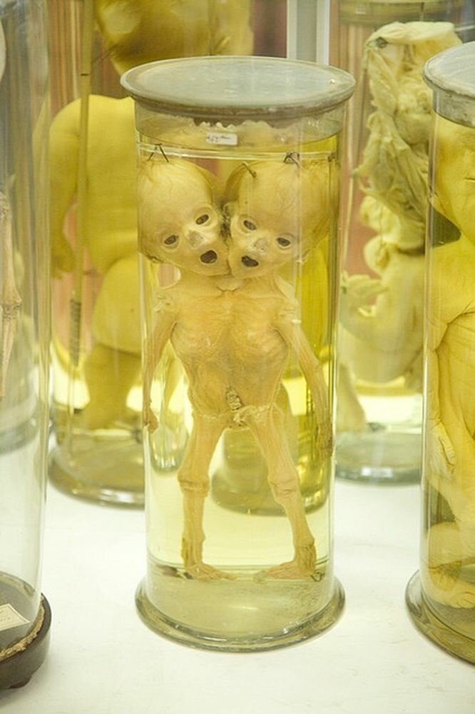 Не для слабонервных: топ-5 самых отвратительных и жутких музеев мира (30 фото)